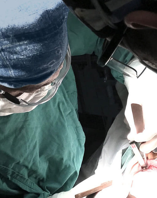 Dr. Mauricio Barreda H., Cirugía bucal y maxilofacial. Extracción de terceros molares, bichectomía, mucocele, implantes dentales, traumas faciales.
